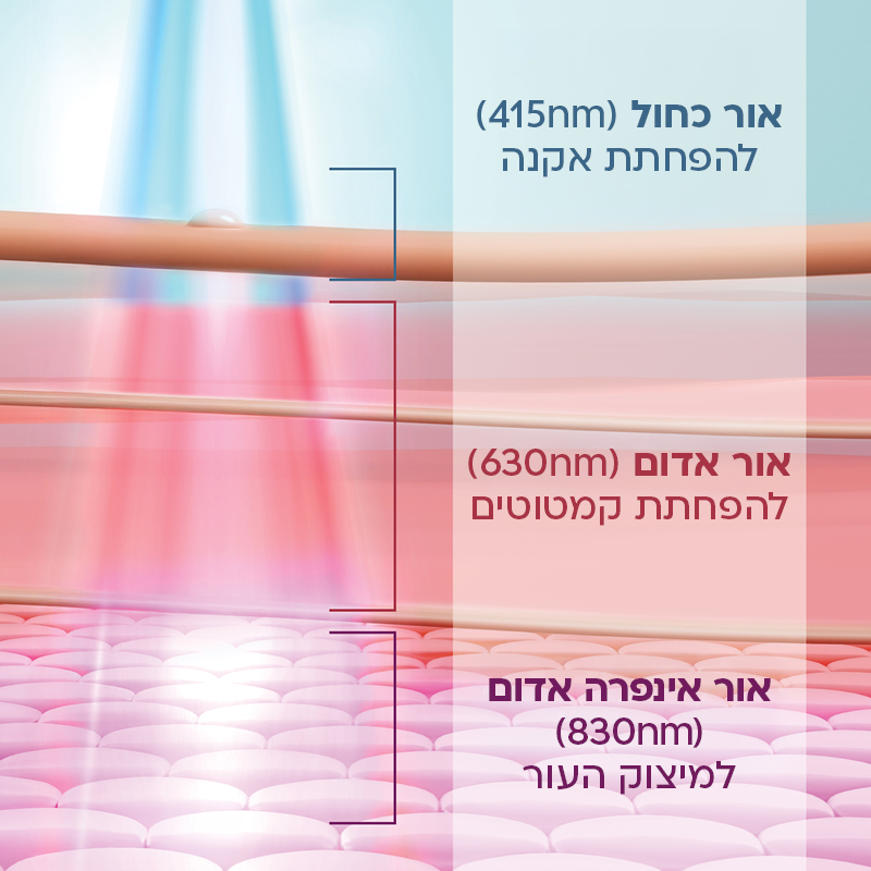 טכנולוגיית iQLED – אור כחול, אדום ואינפרא-אדום לטיפול בעור בעומק