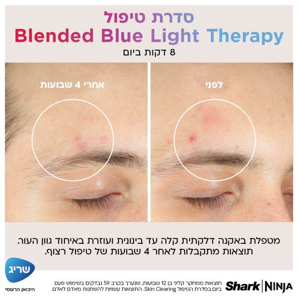 מסכת לד לפנים Shark Beauty CryoGlow דגם FW312EU ארבע סדרות טיפול: טיפול ביתי לאקנה, קמטים, שקיות עיניים ועור זוהר