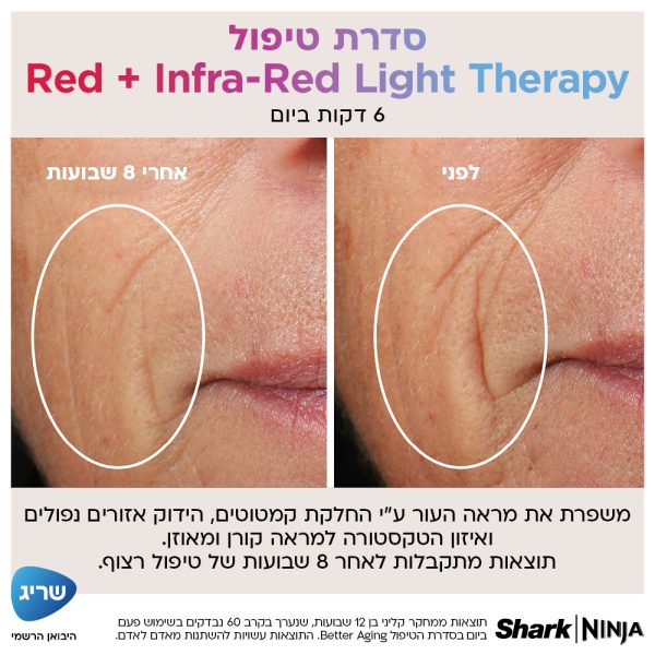 מסכת לד לפנים Shark Beauty CryoGlow דגם FW312EU ארבע סדרות טיפול: טיפול ביתי לאקנה, קמטים, שקיות עיניים ועור זוהר